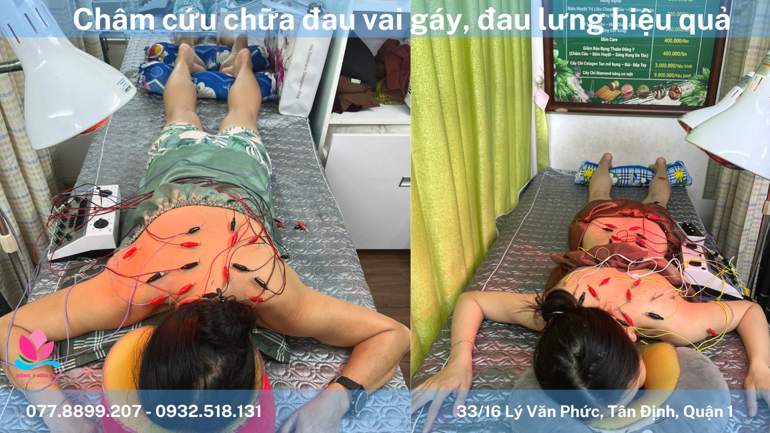 Chữa đau mỏi vai gáy bằng thuốc đông y