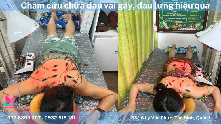 chữa đau vai gáy