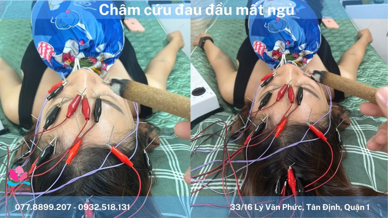 chữa mất ngủ bằng đông y ở đâu