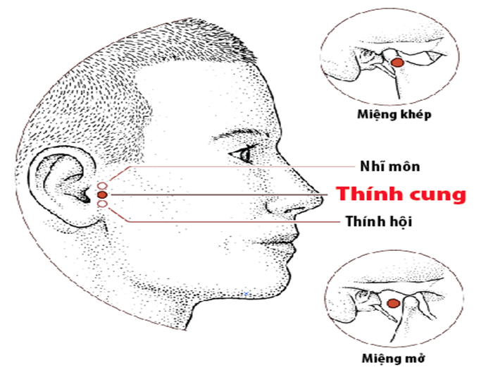 Bấm huyệt chữa buồn nôn