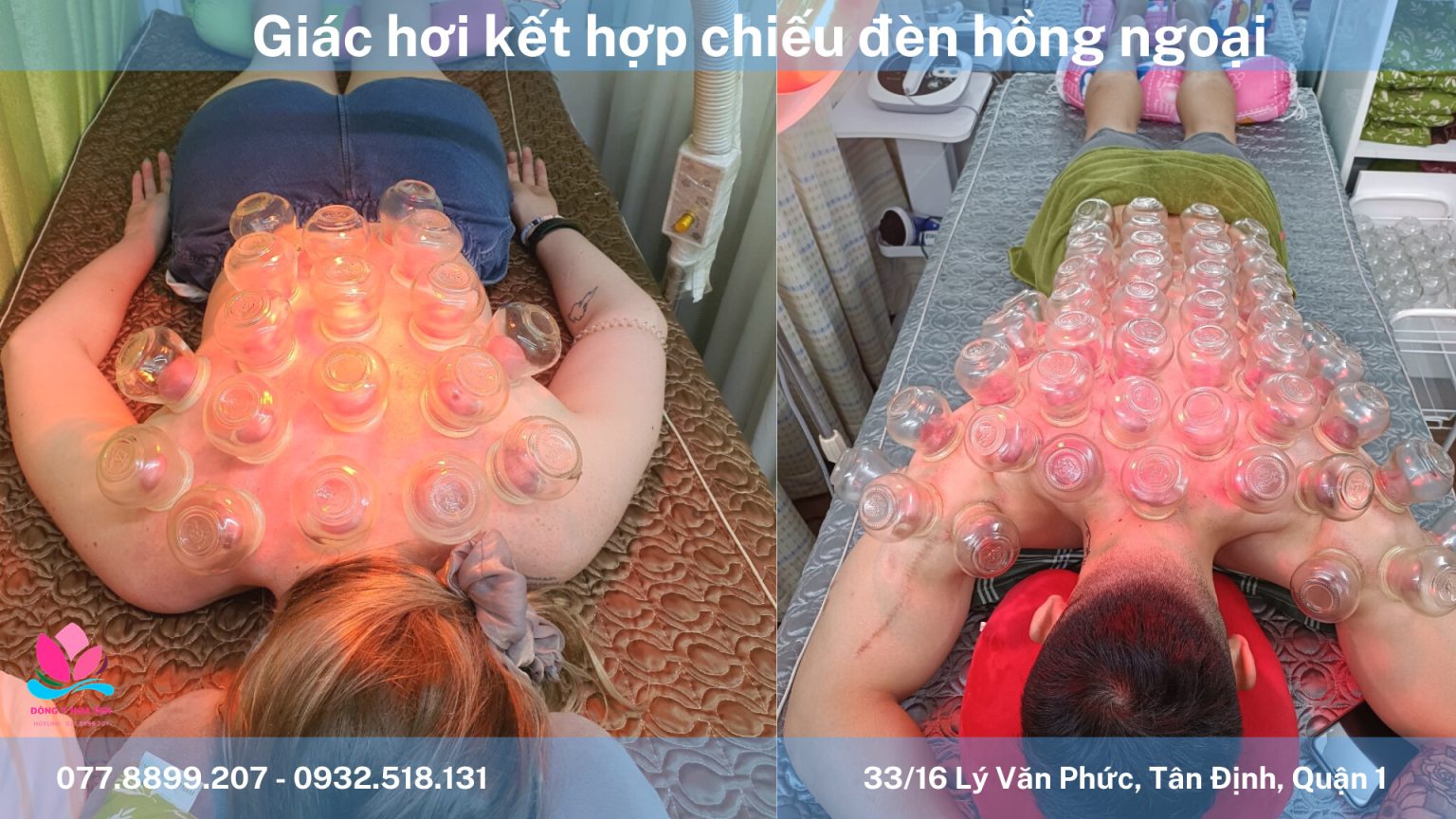 Địa Chỉ Cạo Gió Giác Hơi TPHCM