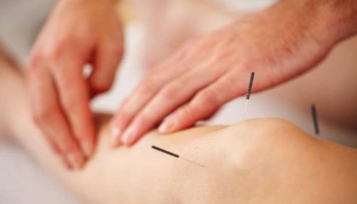 Mách bạn những điều kiêng cử khi châm cứu