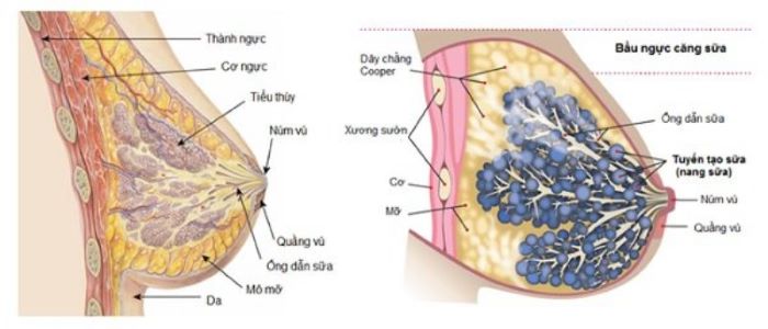 Tắc tia sữa