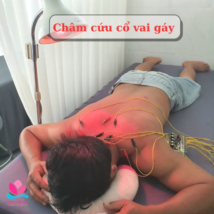 đau vai gáy phải