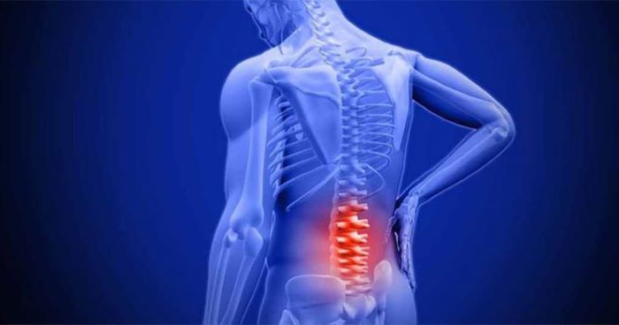 thoái hóa cột sống lưng