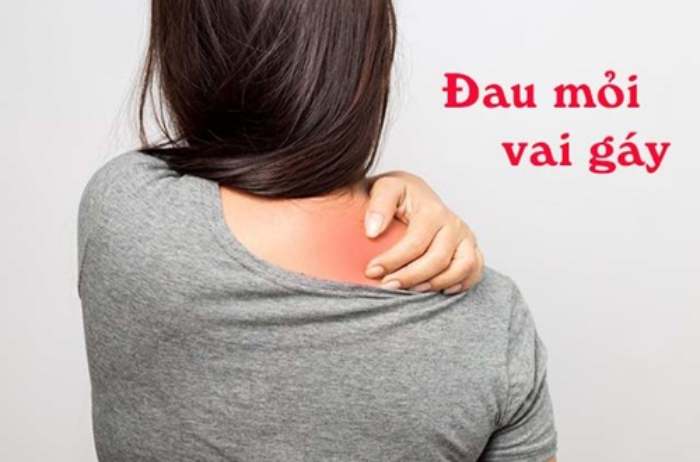 trị đau vai gáy