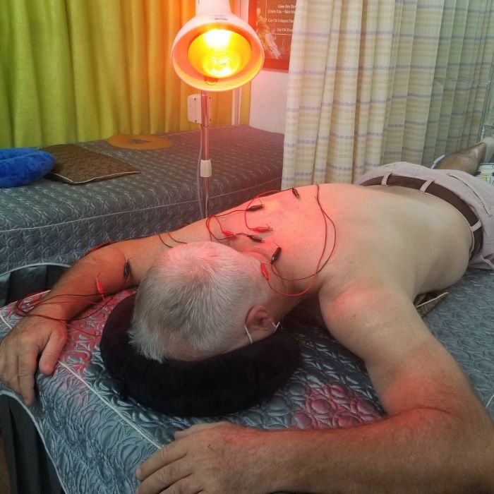 châm cứu tại TPHCM