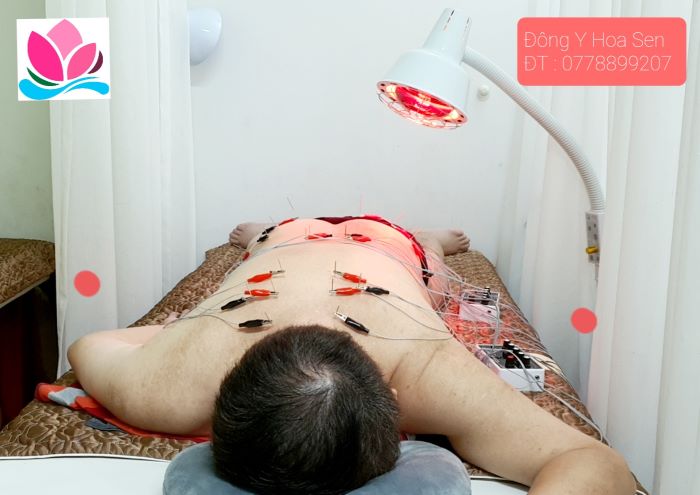 Học châm cứu thoát vị đĩa đệm cấp tốc