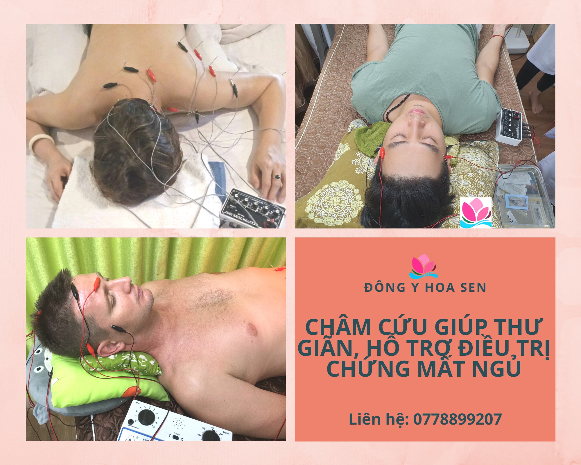 bấm huyệt chữa mất ngủ