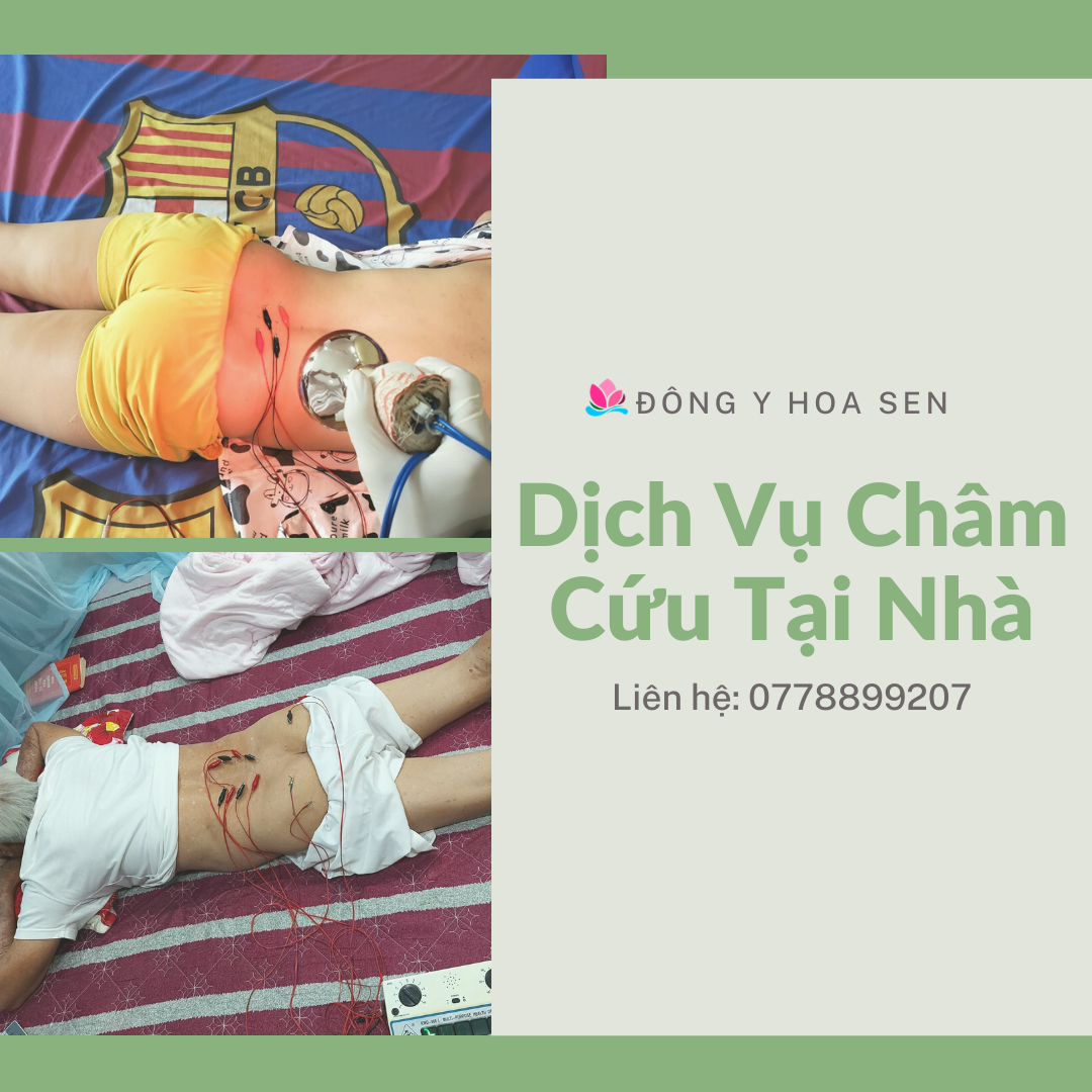 Châm cứu tại nhà giá bao nhiêu