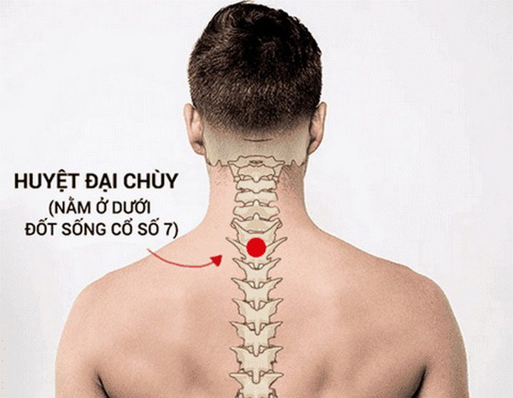 Bấm huyệt nào chữa đau vai gáy ngay lập tức