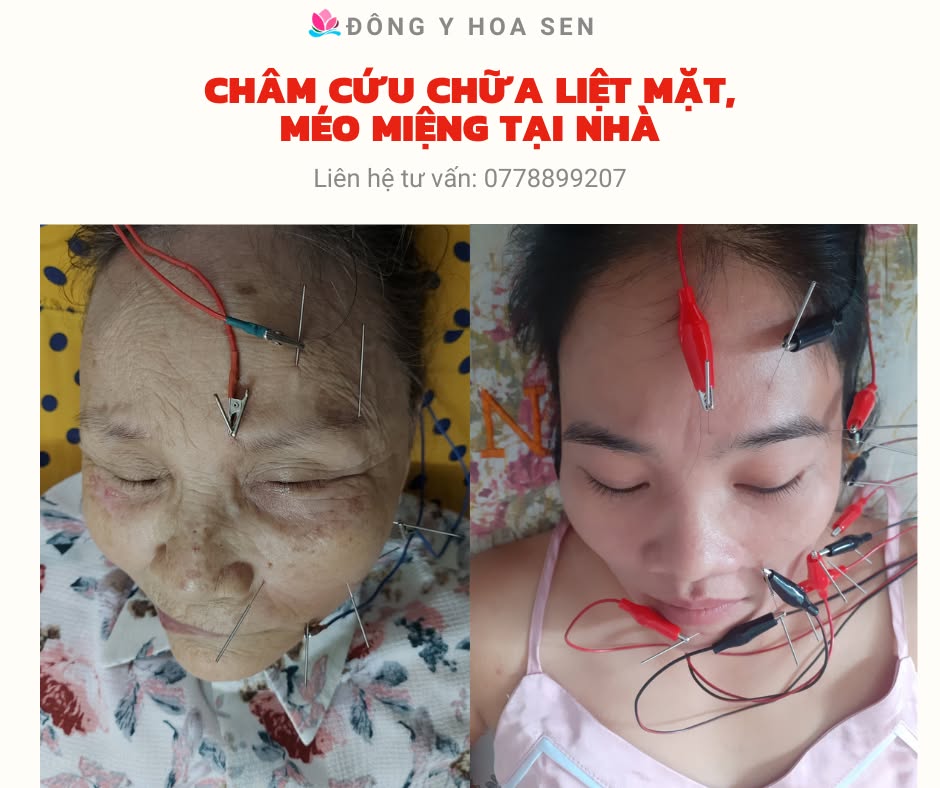 bác sĩ đông y khám bệnh tại nhà